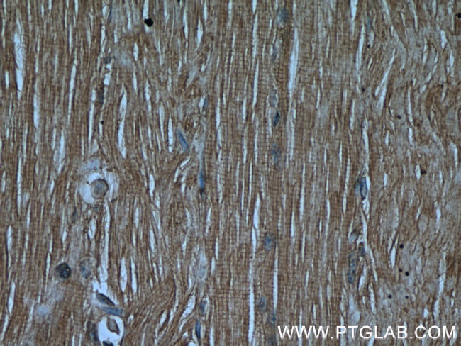 CaMKII gamma Antibody in Immunohistochemistry (Paraffin) (IHC (P))