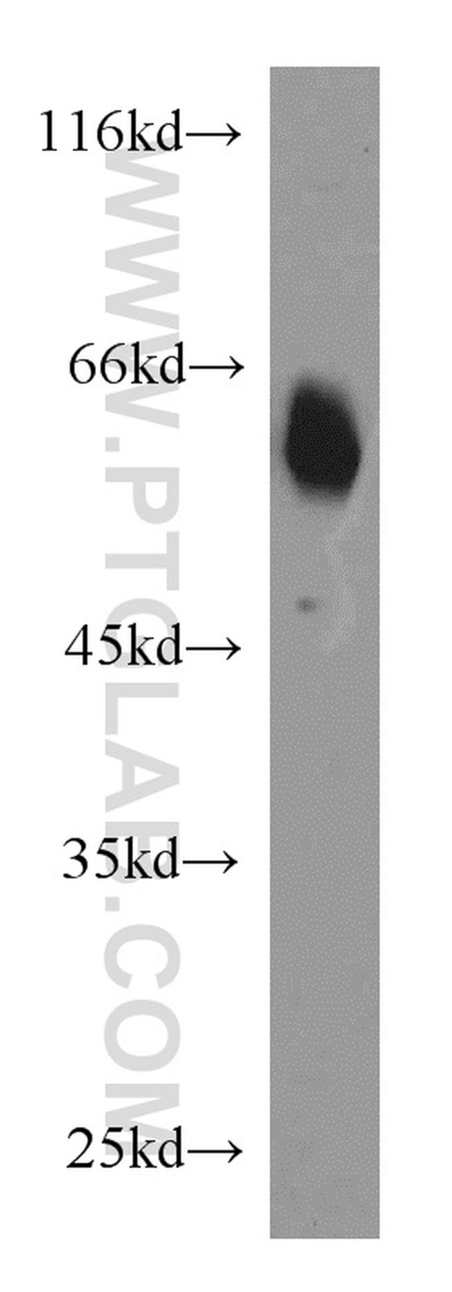 CaMKII gamma Antibody in Western Blot (WB)