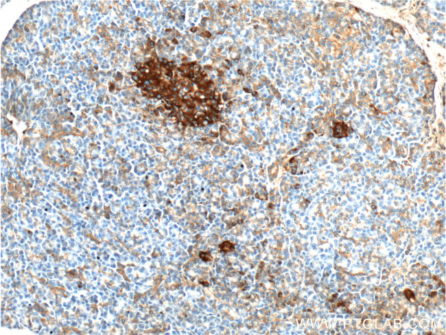 AVPR1B Antibody in Immunohistochemistry (Paraffin) (IHC (P))