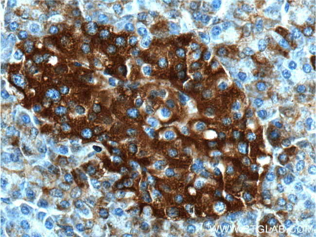 AVPR1B Antibody in Immunohistochemistry (Paraffin) (IHC (P))