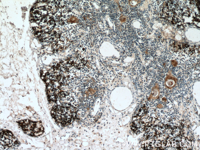 PSMB11 Antibody in Immunohistochemistry (Paraffin) (IHC (P))