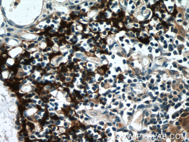 PSMB11 Antibody in Immunohistochemistry (Paraffin) (IHC (P))