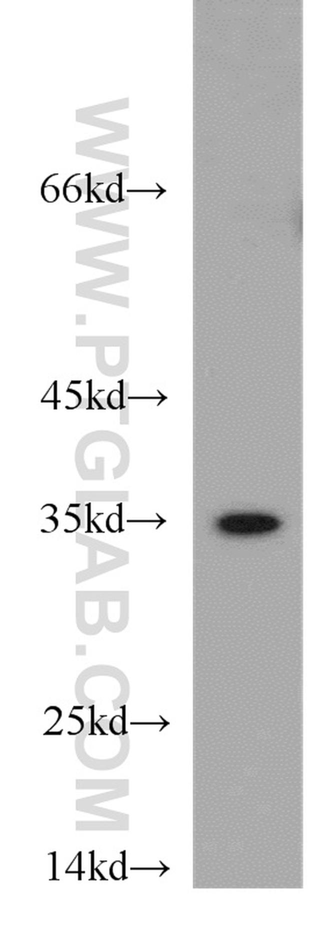 PSMB11 Antibody in Western Blot (WB)