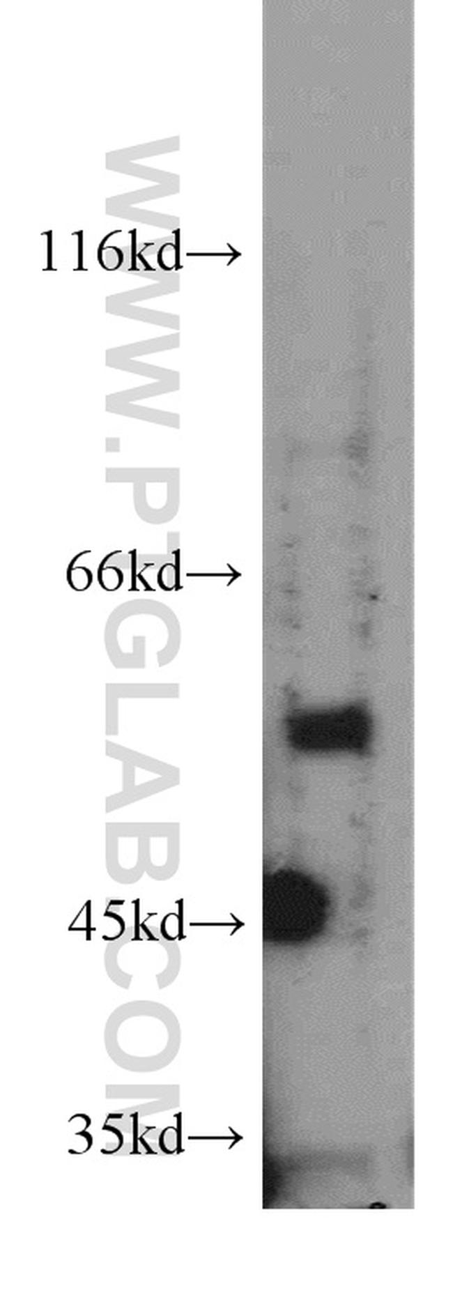 PPP3CA Antibody in Western Blot (WB)