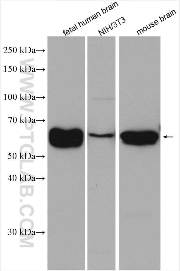 PPP3CB Antibody in Western Blot (WB)