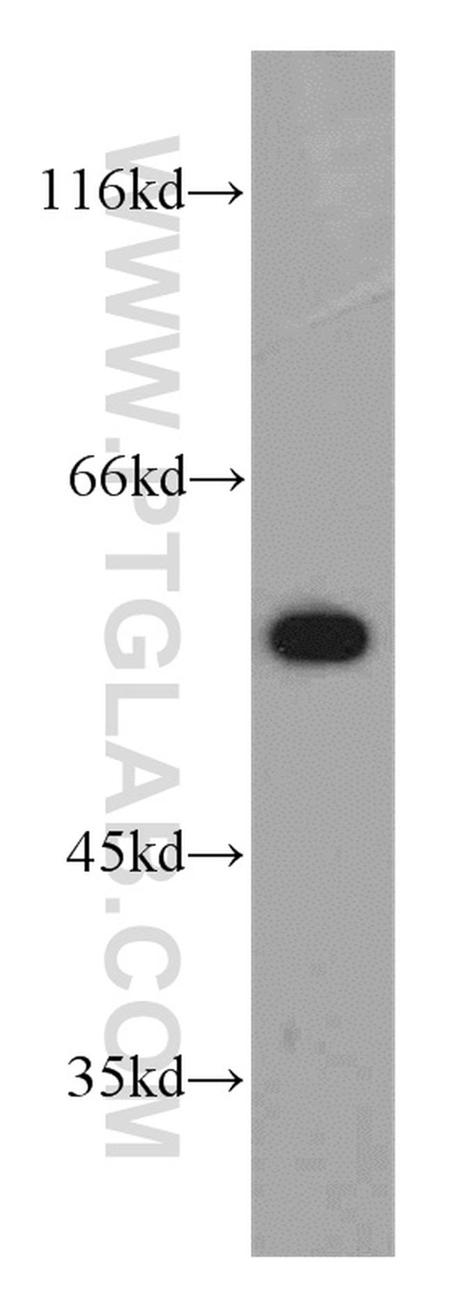 PPP3CB Antibody in Western Blot (WB)