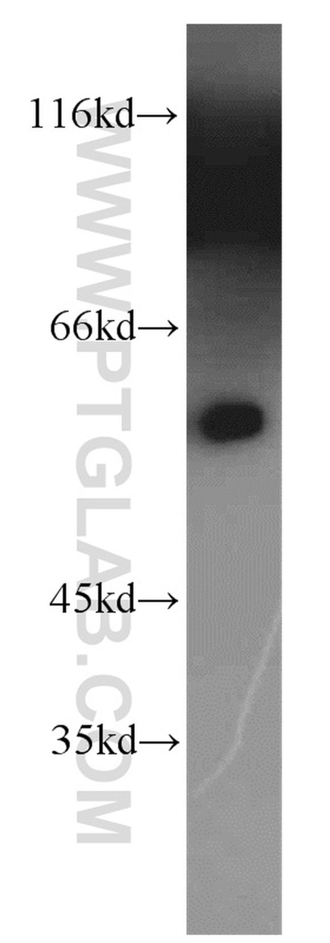 PPP3CB Antibody in Western Blot (WB)