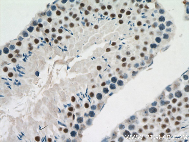 PARP2 Antibody in Immunohistochemistry (Paraffin) (IHC (P))