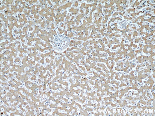 PPP1CC Antibody in Immunohistochemistry (Paraffin) (IHC (P))