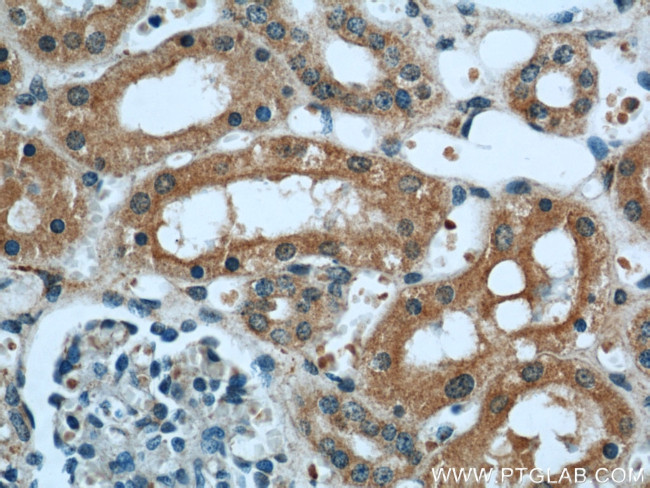 TULP4 Antibody in Immunohistochemistry (Paraffin) (IHC (P))