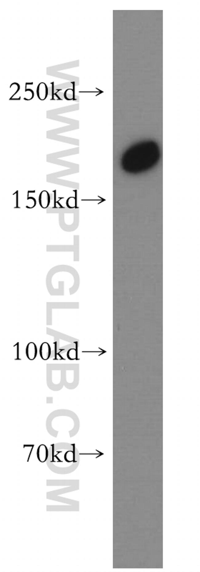 TULP4 Antibody in Western Blot (WB)