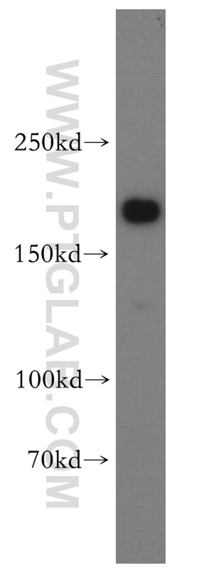 TULP4 Antibody in Western Blot (WB)