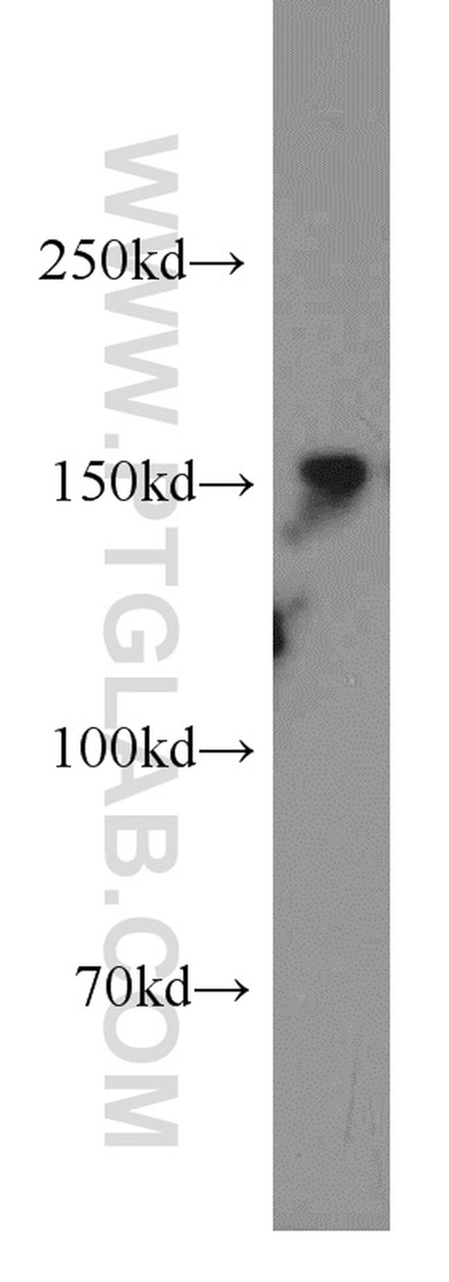 XDH Antibody in Western Blot (WB)