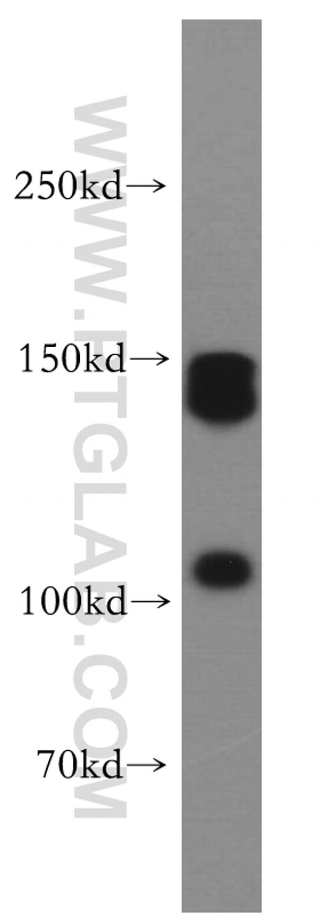 XDH Antibody in Western Blot (WB)