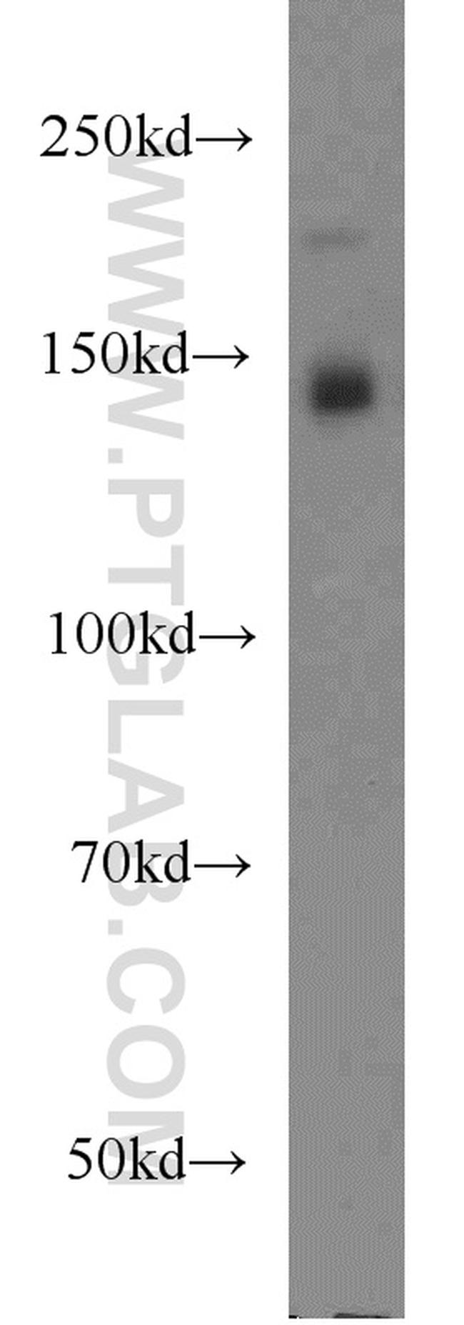 XDH Antibody in Western Blot (WB)