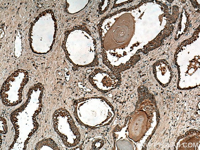 IDUA Antibody in Immunohistochemistry (Paraffin) (IHC (P))