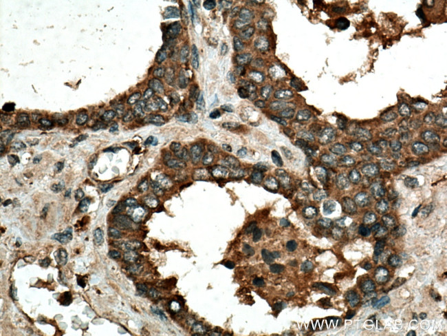 IDUA Antibody in Immunohistochemistry (Paraffin) (IHC (P))