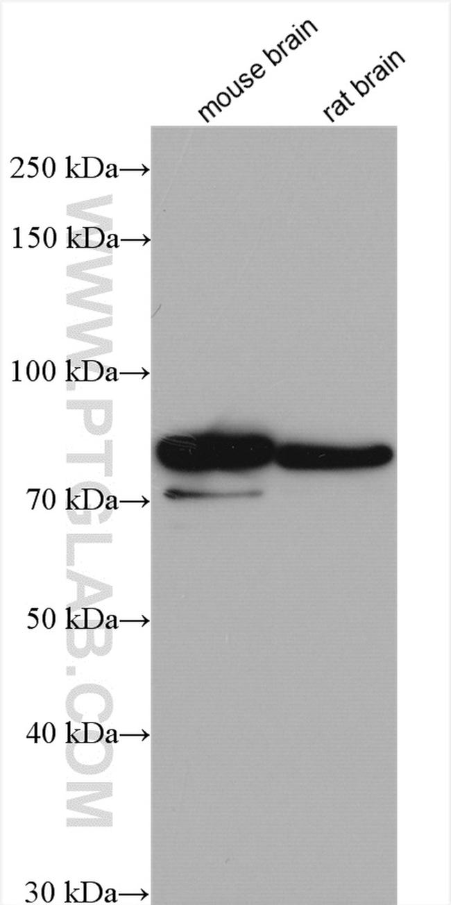 IDUA Antibody in Western Blot (WB)