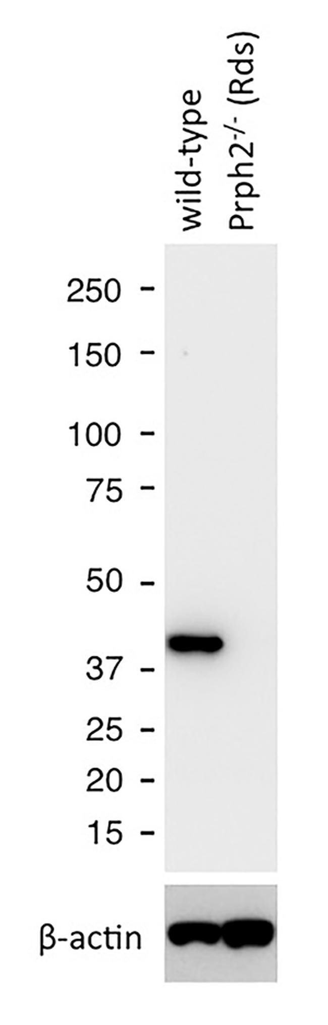 GNAT1 Antibody in Western Blot (WB)