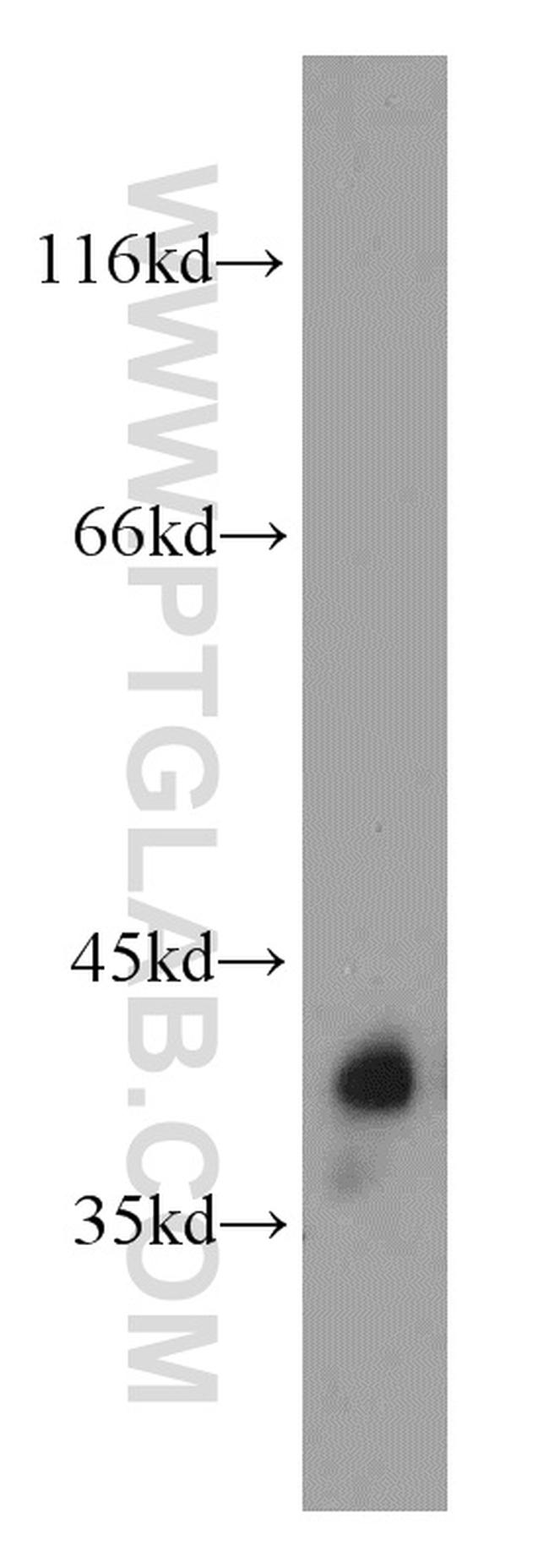 GNAT1 Antibody in Western Blot (WB)