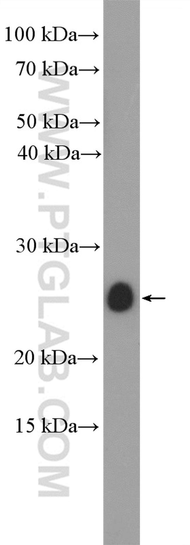 IL11 Antibody in Western Blot (WB)