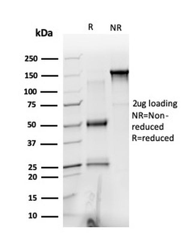 PRMT6 Antibody in SDS-PAGE (SDS-PAGE)