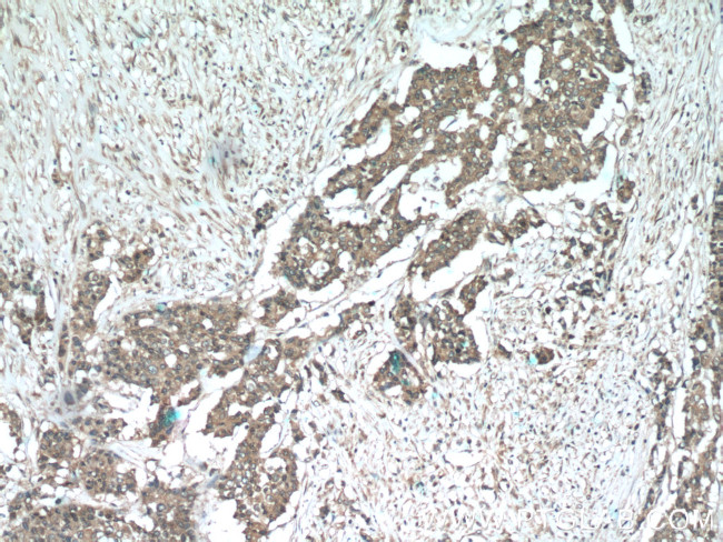 SMURF1 Antibody in Immunohistochemistry (Paraffin) (IHC (P))