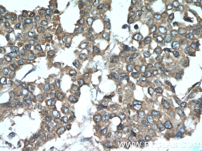 SMURF1 Antibody in Immunohistochemistry (Paraffin) (IHC (P))