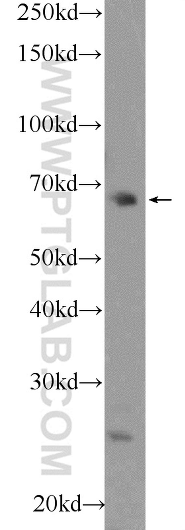 FBXO43 Antibody in Western Blot (WB)