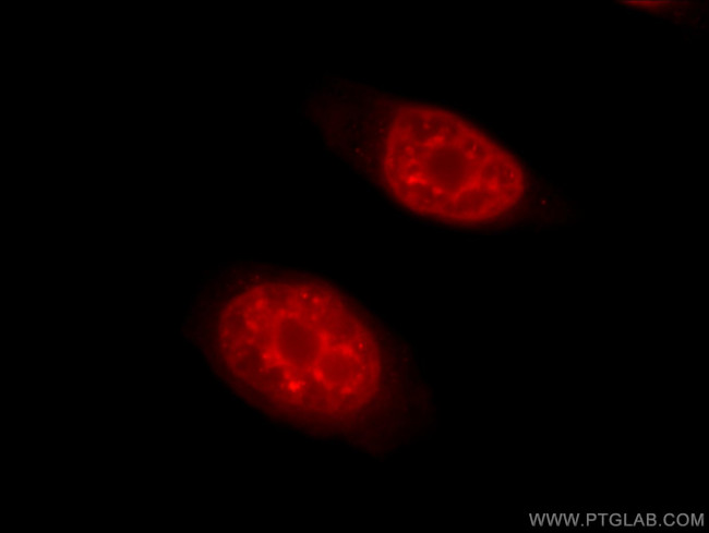 THOC2 Antibody in Immunocytochemistry (ICC/IF)