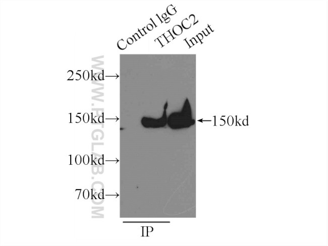THOC2 Antibody in Immunoprecipitation (IP)