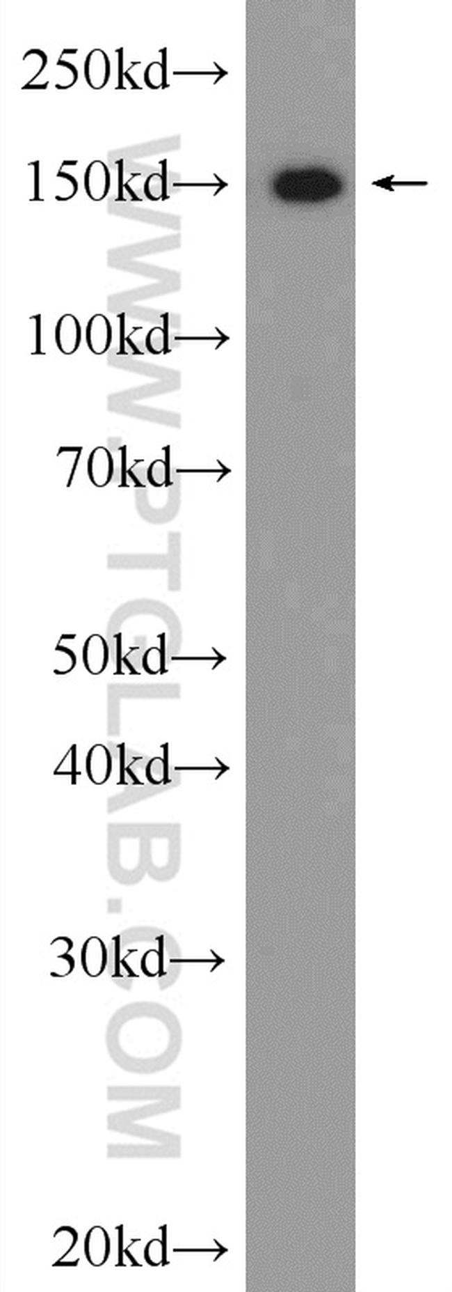 THOC2 Antibody in Western Blot (WB)