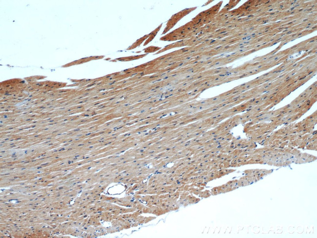 ATP1A2 Antibody in Immunohistochemistry (Paraffin) (IHC (P))