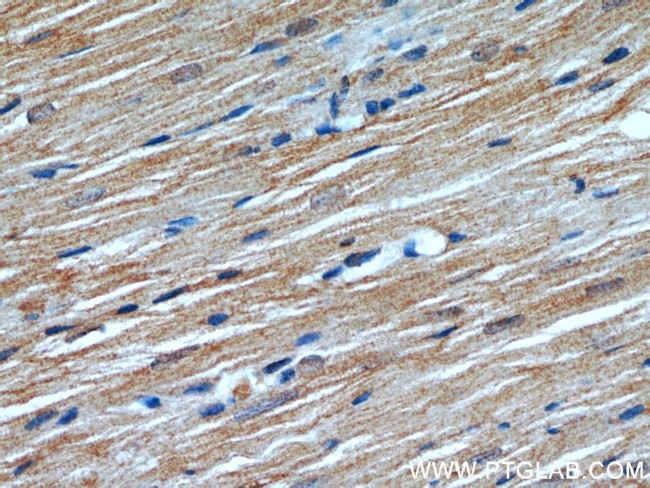 ATP1A2 Antibody in Immunohistochemistry (Paraffin) (IHC (P))