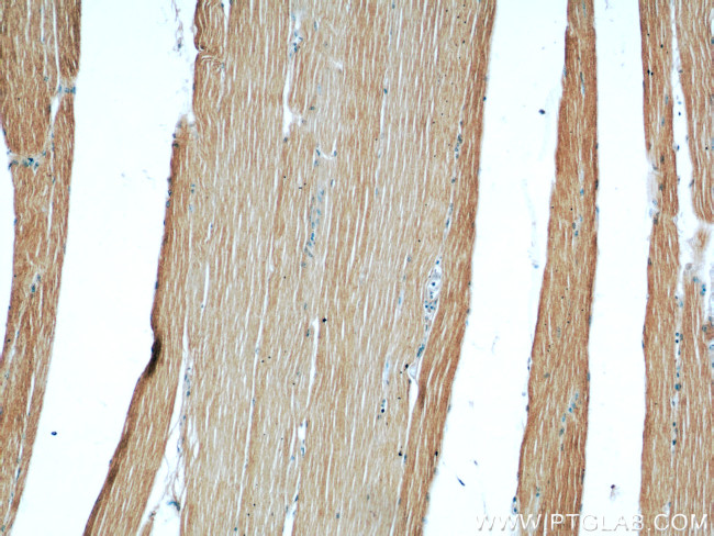 ATP1A2 Antibody in Immunohistochemistry (Paraffin) (IHC (P))