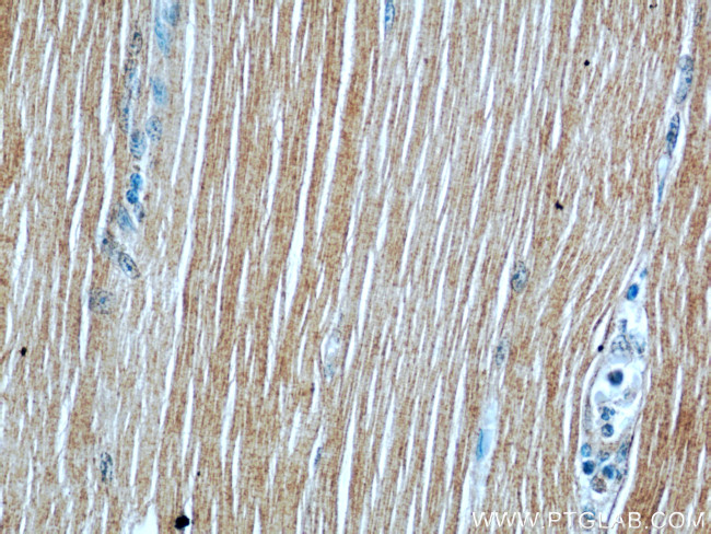 ATP1A2 Antibody in Immunohistochemistry (Paraffin) (IHC (P))