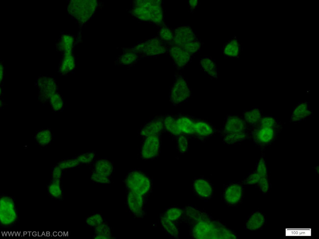 PTBP1 Antibody in Immunocytochemistry (ICC/IF)