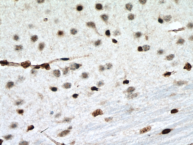 PTBP1 Antibody in Immunohistochemistry (Paraffin) (IHC (P))