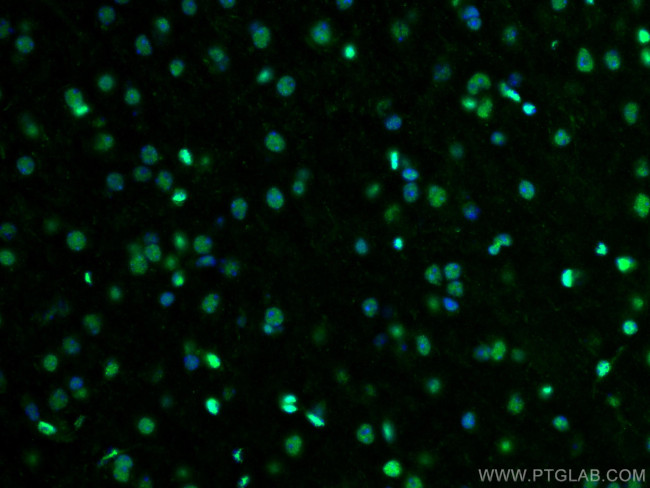 PTBP1 Antibody in Immunohistochemistry (PFA fixed) (IHC (PFA))