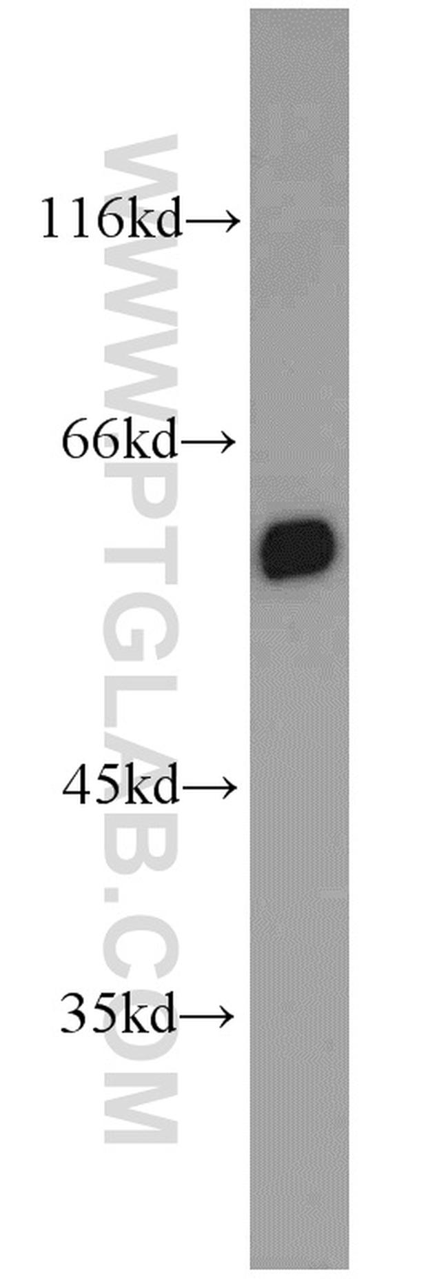 PTBP1 Antibody in Western Blot (WB)