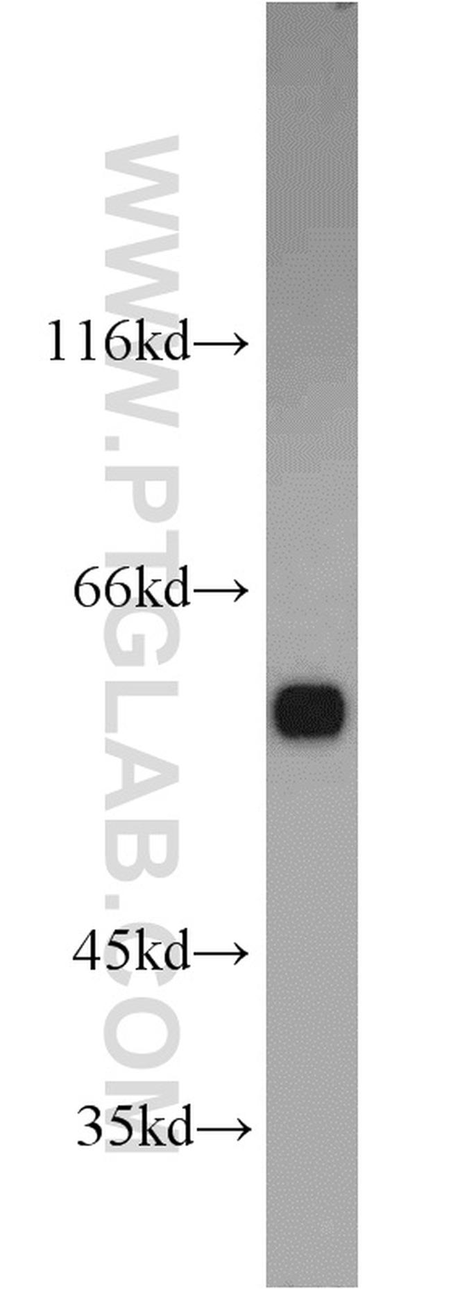 PTBP1 Antibody in Western Blot (WB)