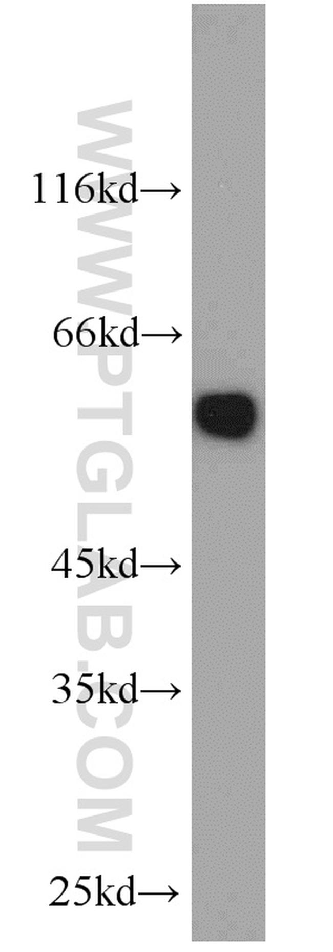 PTBP1 Antibody in Western Blot (WB)