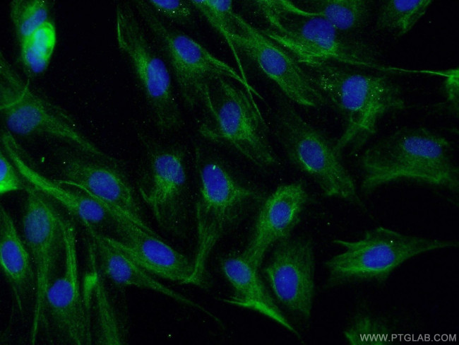 p150 glued Antibody in Immunocytochemistry (ICC/IF)