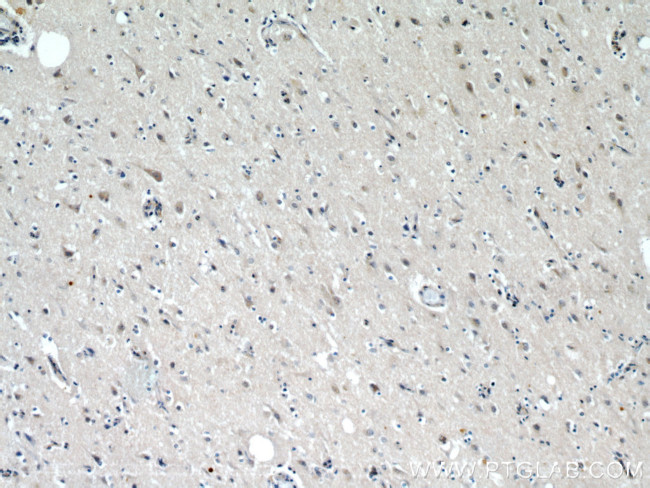 p150 glued Antibody in Immunohistochemistry (Paraffin) (IHC (P))