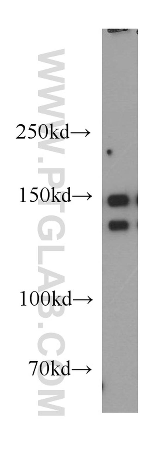 p150 glued Antibody in Western Blot (WB)