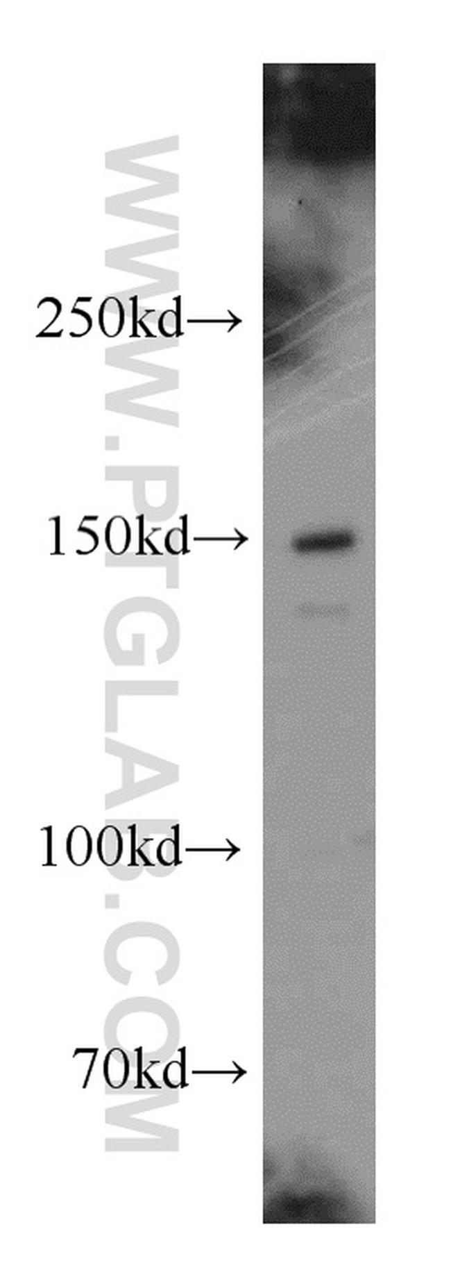 p150 glued Antibody in Western Blot (WB)