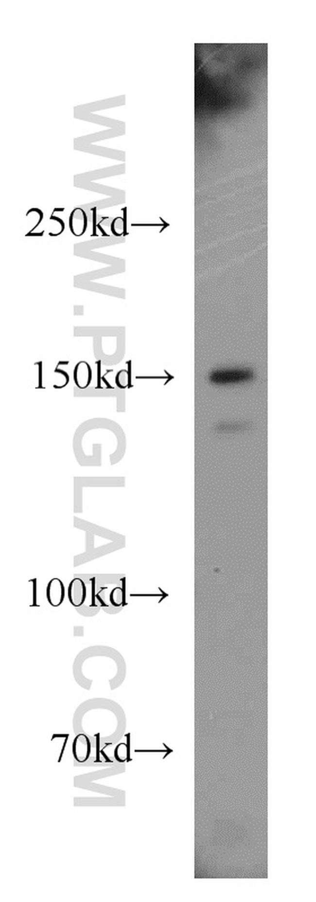 p150 glued Antibody in Western Blot (WB)