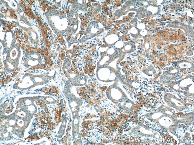 WNT5A/B Antibody in Immunohistochemistry (Paraffin) (IHC (P))