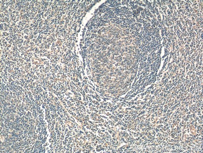 WNT5A/B Antibody in Immunohistochemistry (Paraffin) (IHC (P))