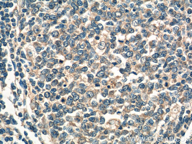 WNT5A/B Antibody in Immunohistochemistry (Paraffin) (IHC (P))